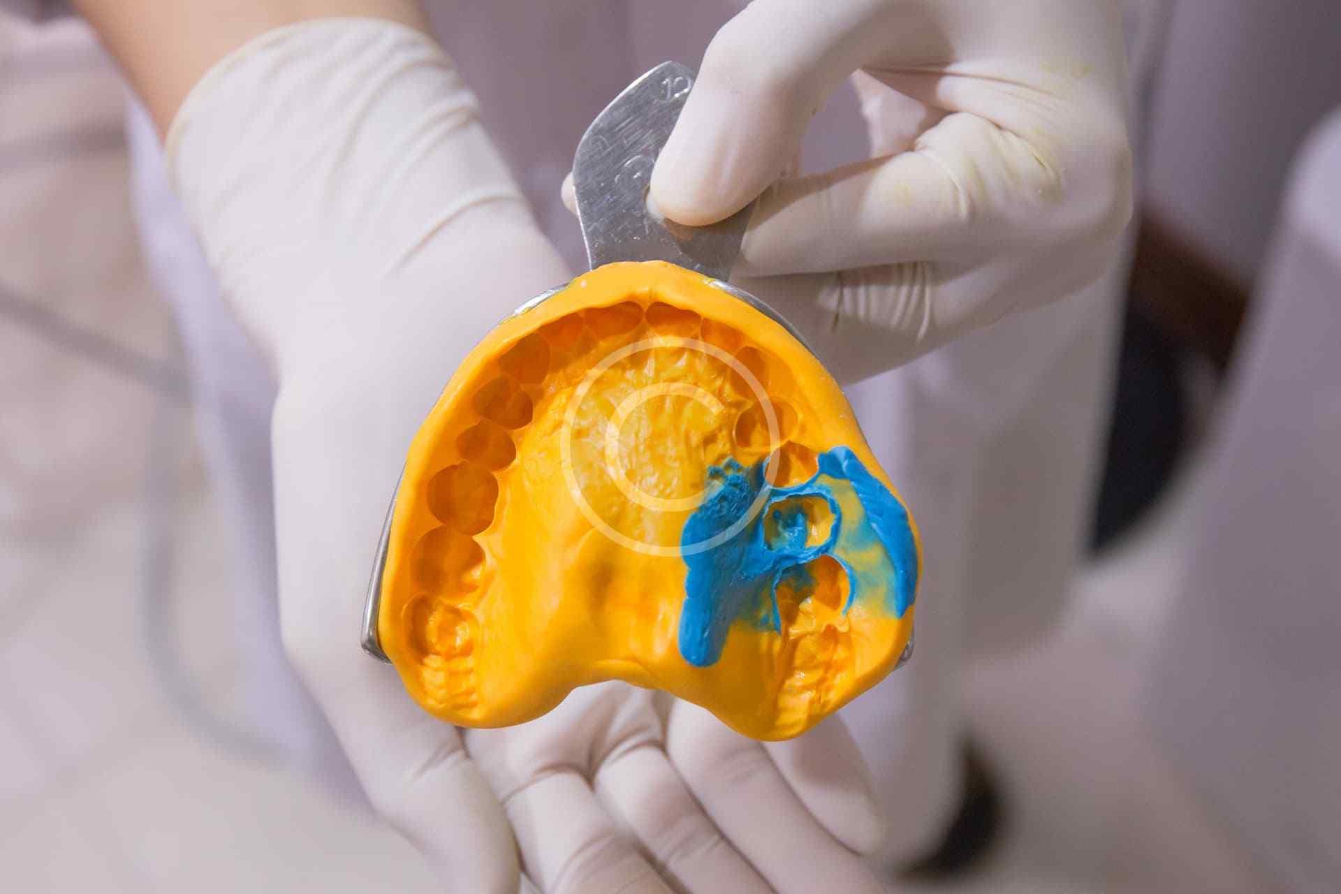 Invisalign for Teens